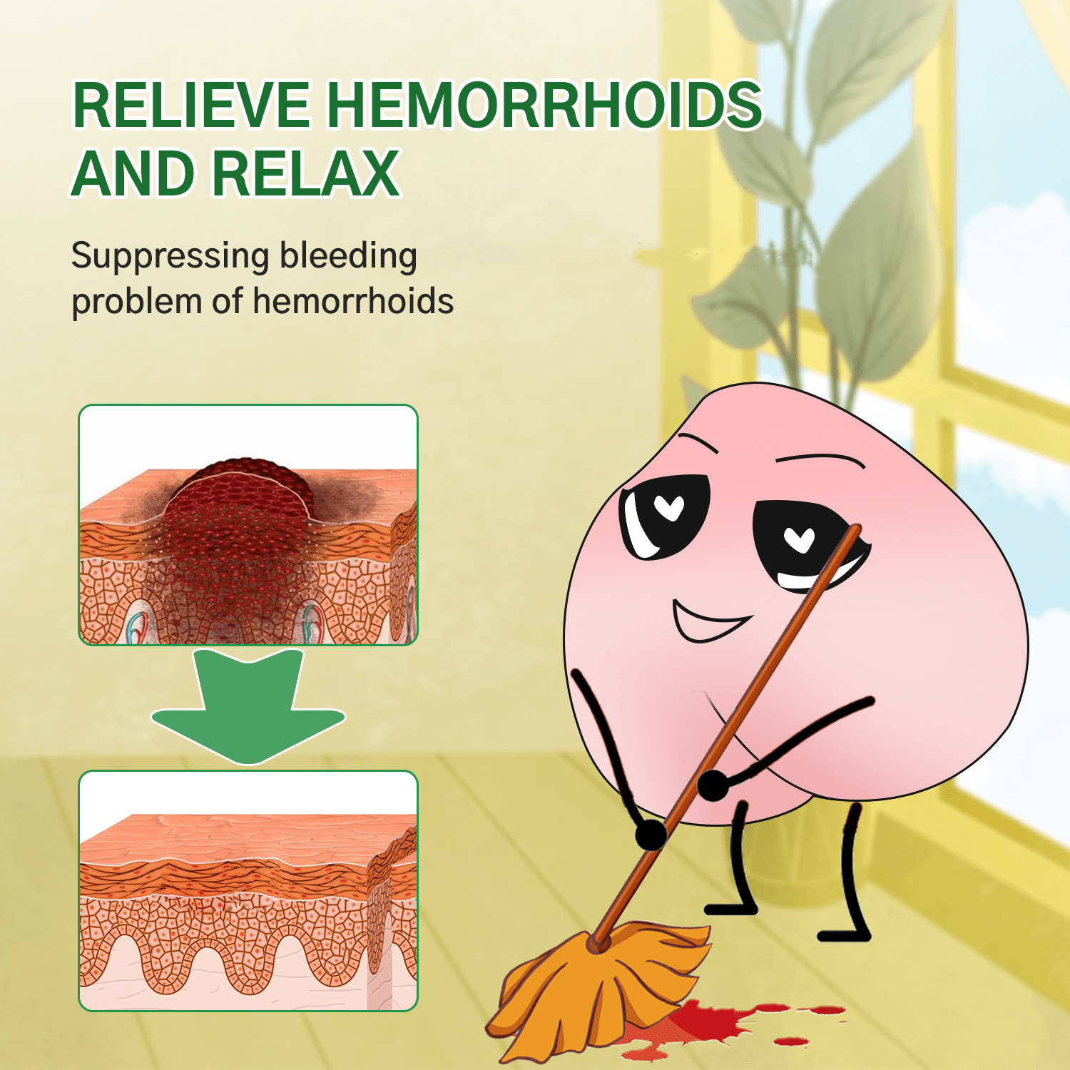 Hemorrhoid Ointment Hemorrhoid Temu