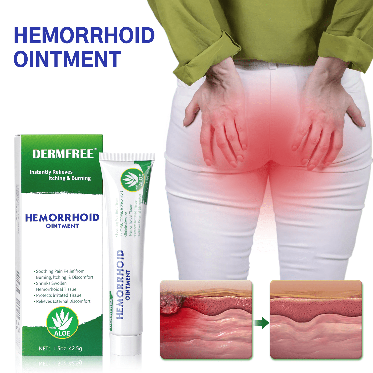 Hemorrhoid Ointment Hemorrhoid Hemorrhoid Temu