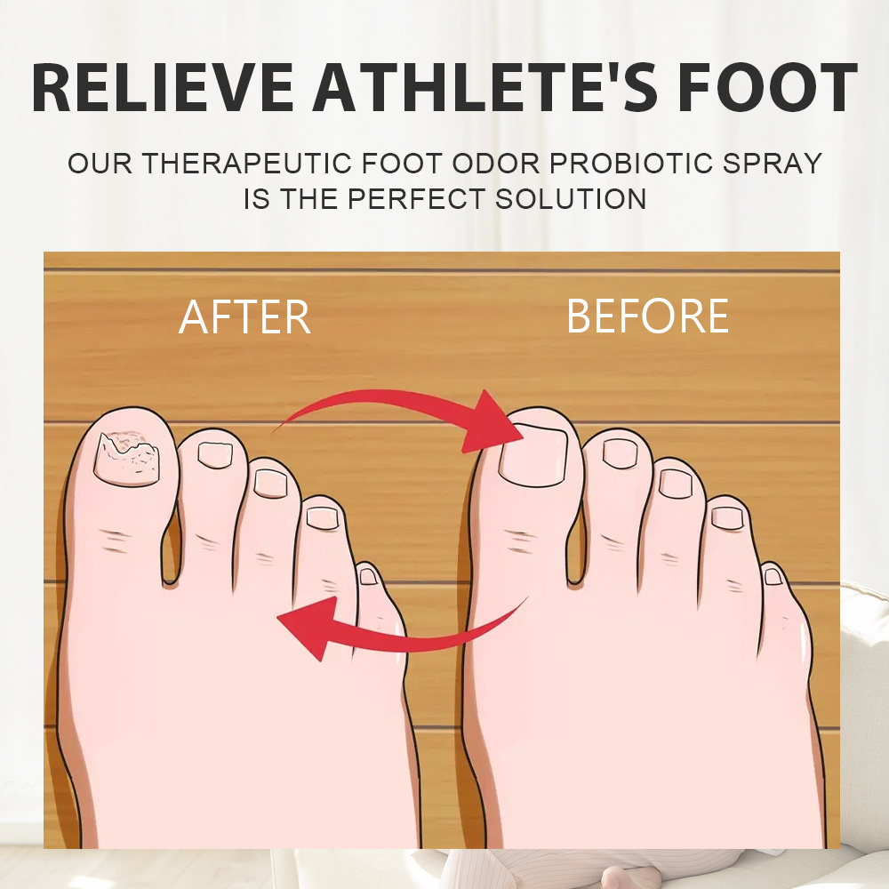 Probiotic Foot Deodorant Spray Deodorizing Foot Spray Home Temu