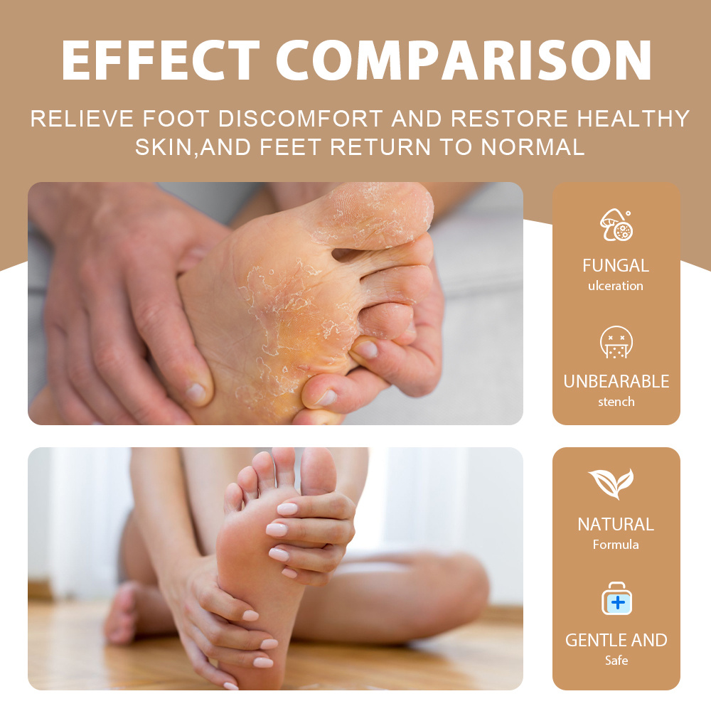 Probiotic Foot Deodorant Spray Deodorizing Foot Spray Home Temu