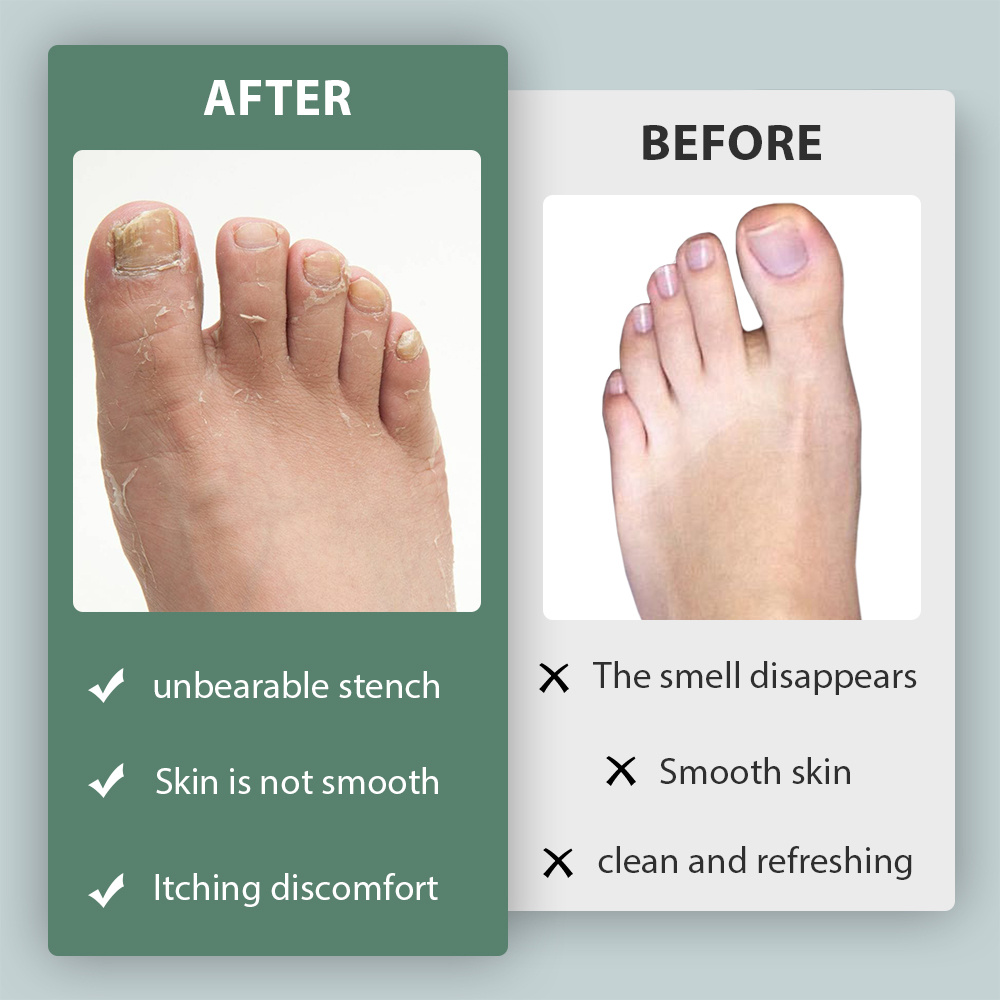 Probiotic Foot Deodorant Spray Deodorizing Foot Spray Home Temu