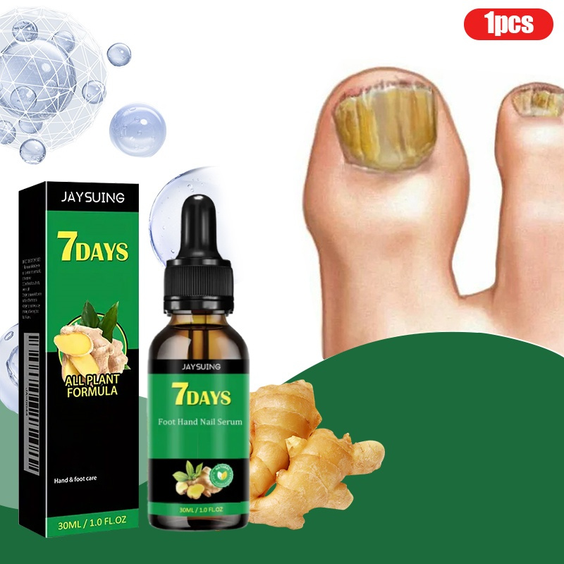 TEMU Toenail Care Serum: Nail Care Serum Solution For Toenail Or Fingernail - Strong Care Serum For Discolored Or Nail,for Thick, Discolored, Damaged