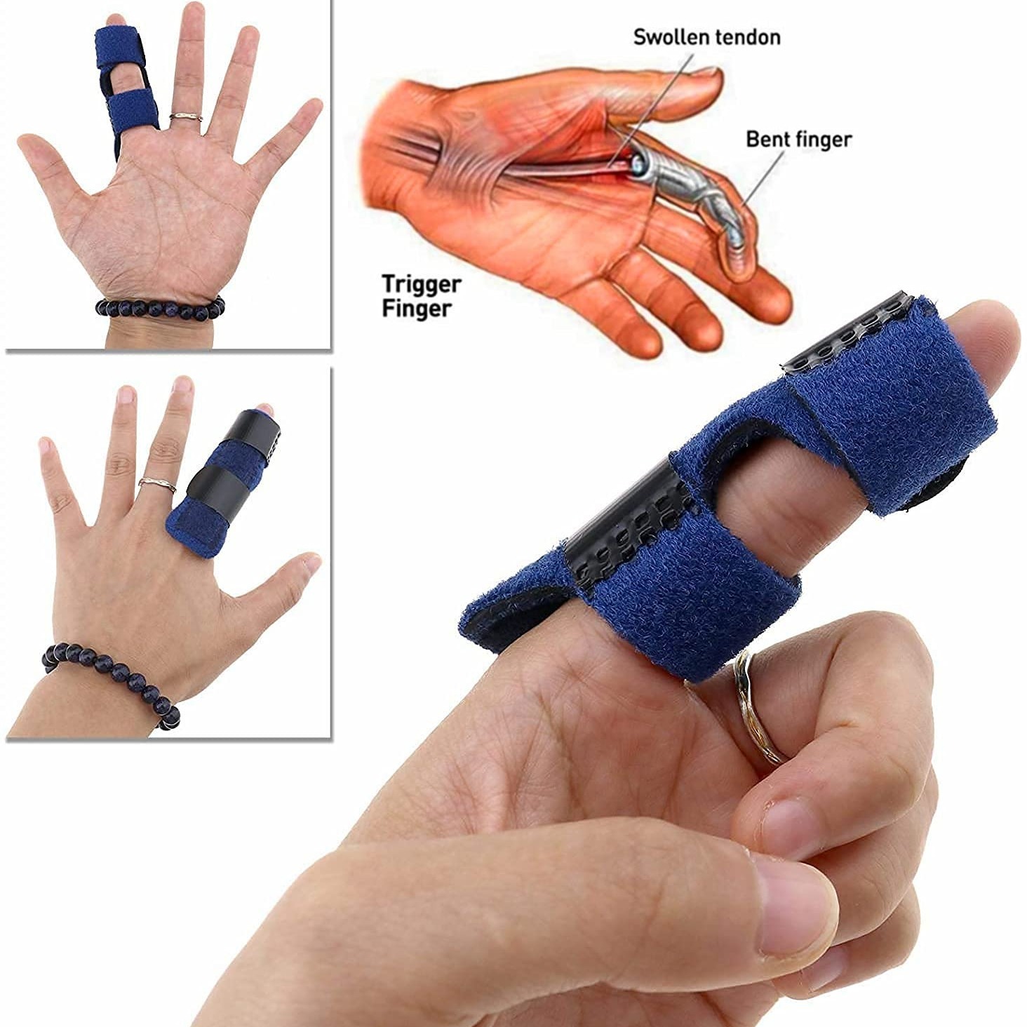 Adjustable Trigger Fixer Finger Splint For Sprains, Dislocations