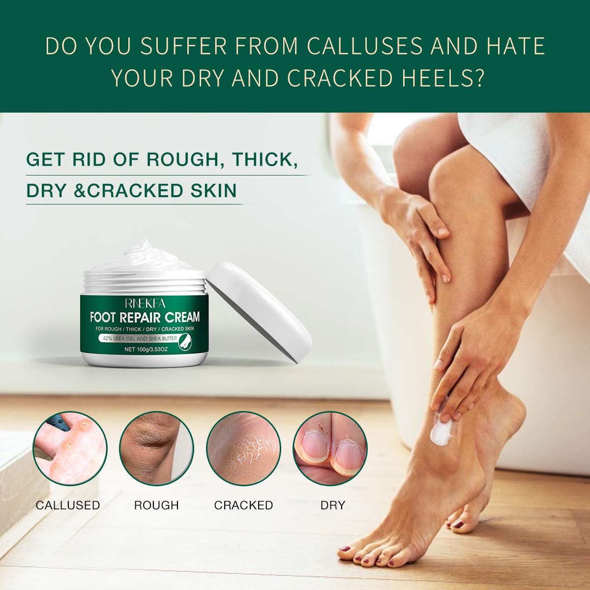 Urea 42 Foot Cream Callus Repair Cream