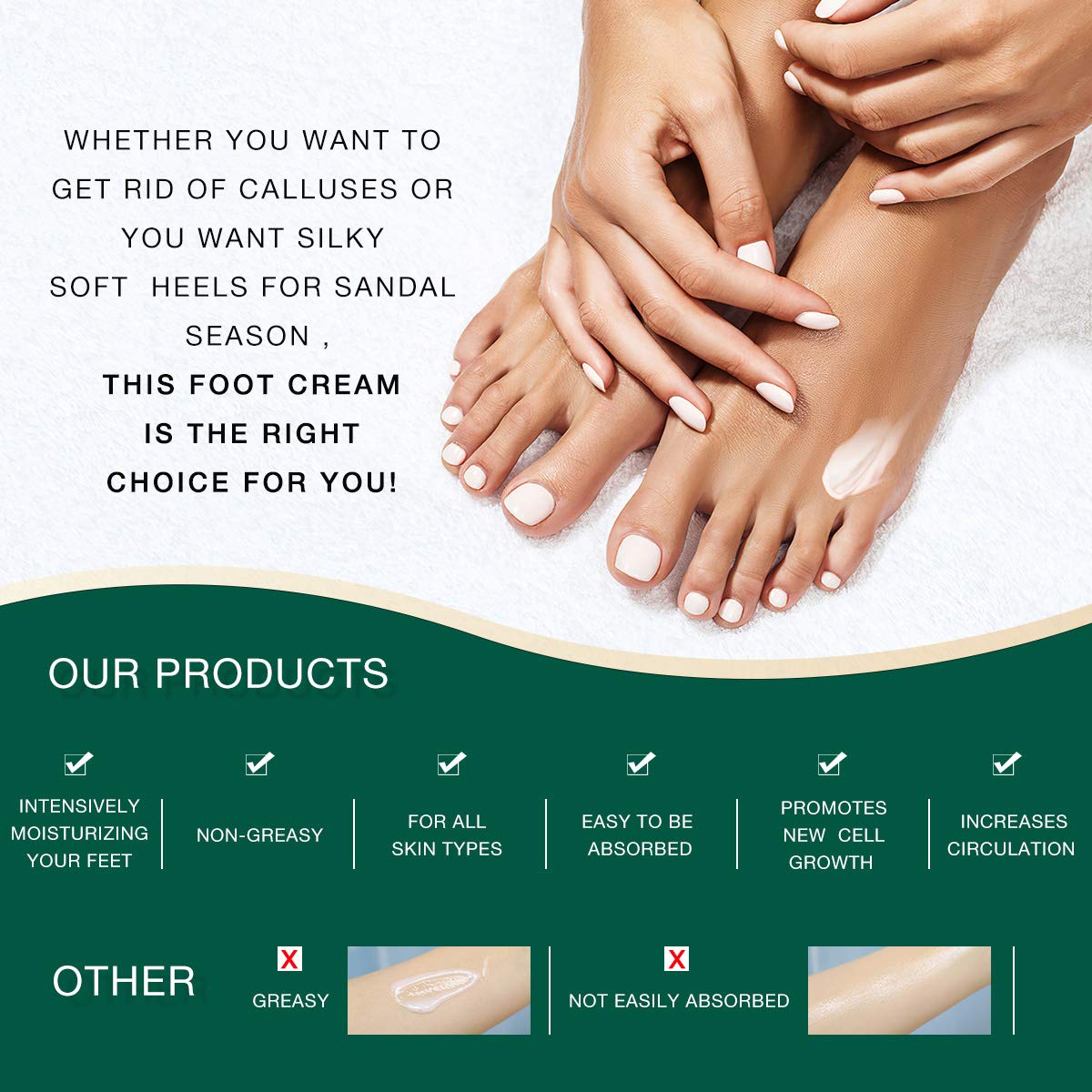 Urea 42 Foot Cream Callus Repair Cream