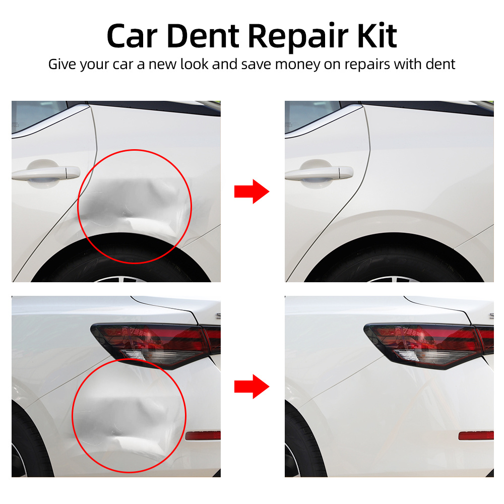 Car Dent Puller, ventouses outils de suppression de corps d'auto forte  ventouse kit de réparation de voiture accessoires de voiture