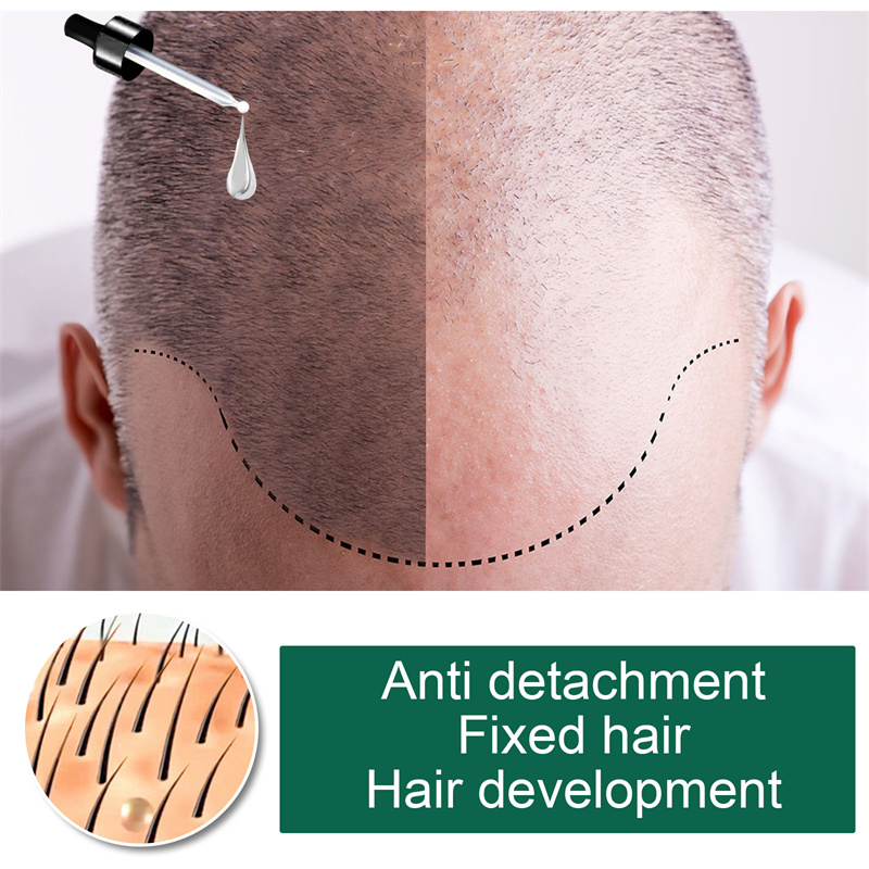 hair care serum oil natural ginger germinal essential oil hair care product hair care oil for women men thicker longer fuller healthier hair details 1