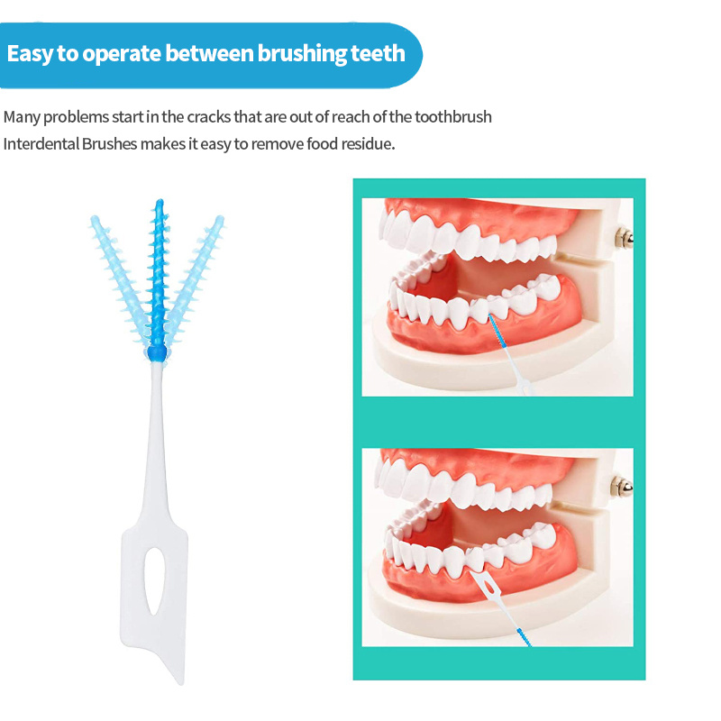 Interdental Brushes Clean Teeth Breath 've Temu