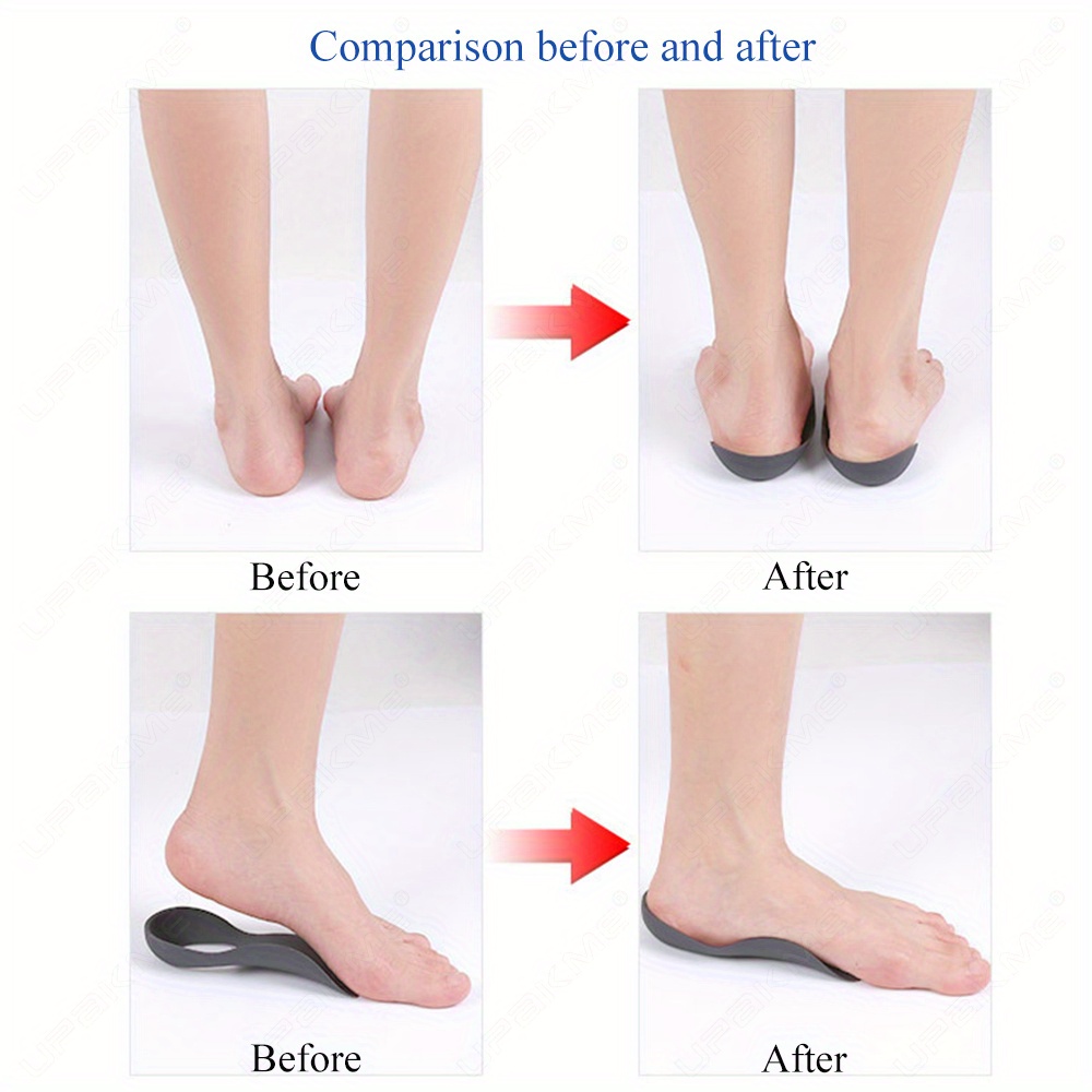 Orthotic Insoles Flat Feet O shaped Legs Unisex Arch Support - Temu