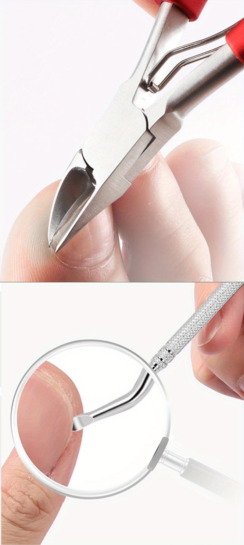 Ingrown Toenail Pedicure Kit Ingrown Toenail Removal Temu