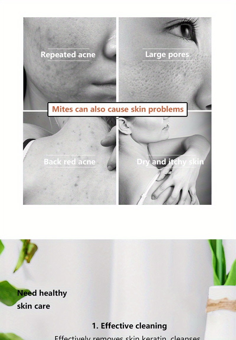 Kojic Acid Soap Lightens Skin Tone, Moisturizes, Removes Chicken Skin, Exfoliates, Controls Oil