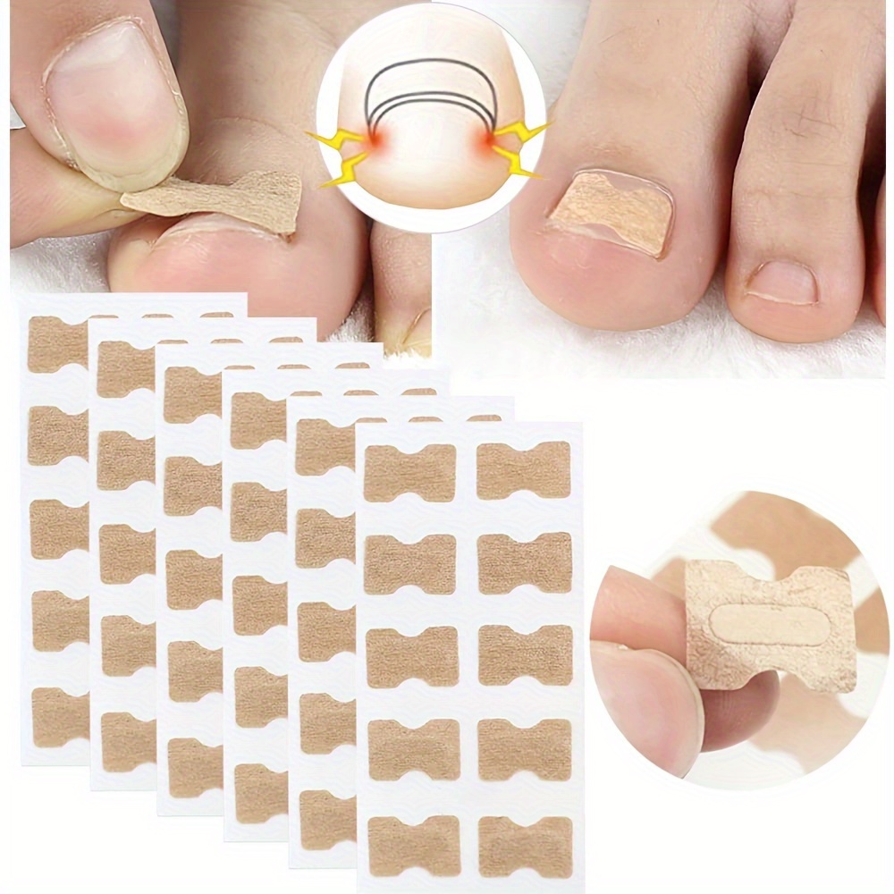 1psc Thick & Ingrown Nails Professional Wide Opening Toe Nail