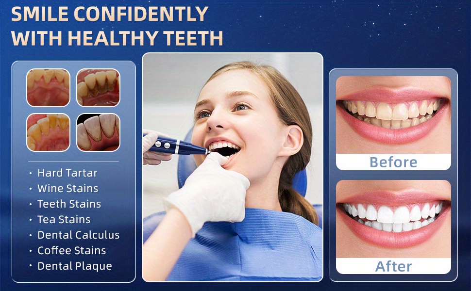 rimozione della placca per il tartaro dei denti - Temu Italy