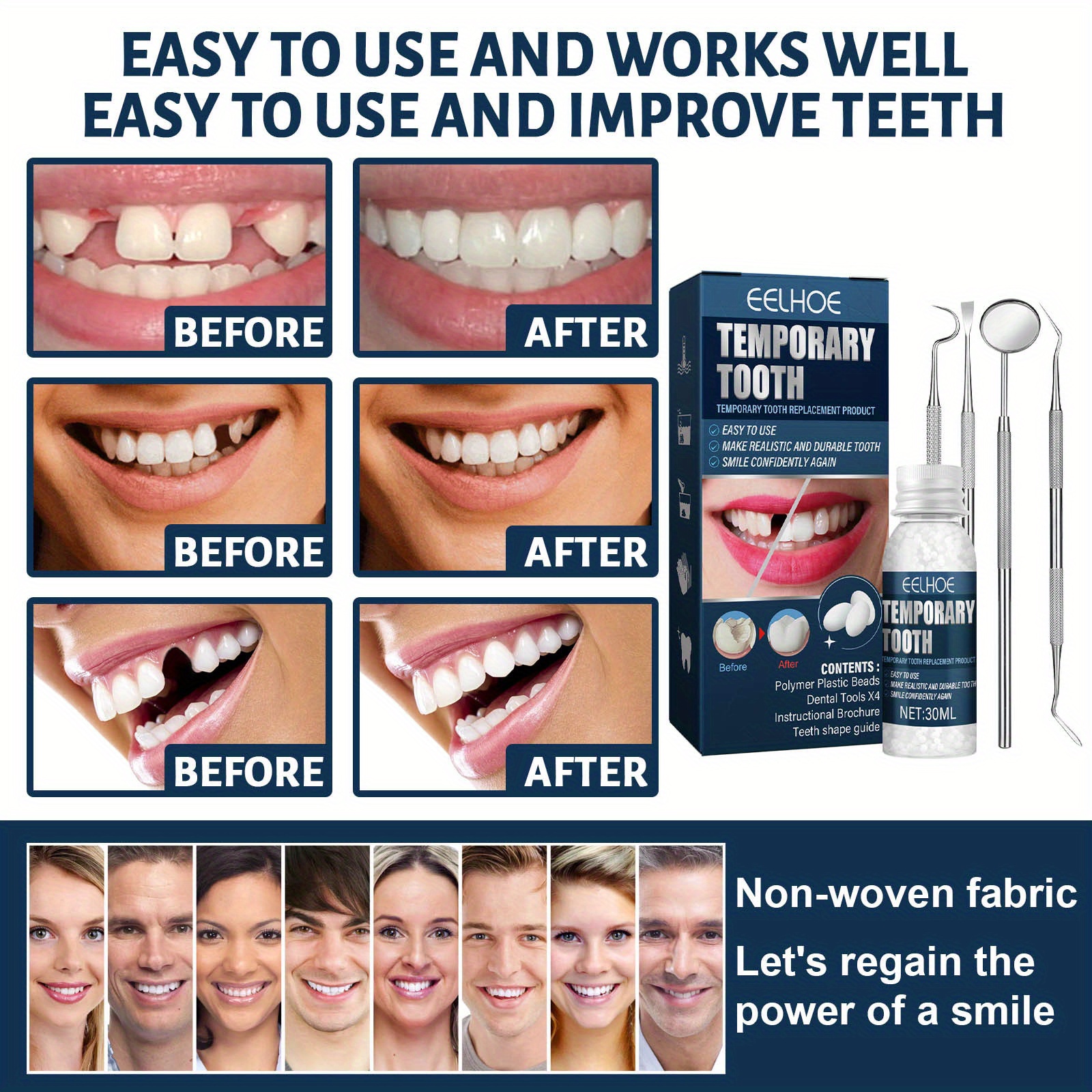 Tooth Kit Temporary Teeth Replacement Kit For Temporary - Temu