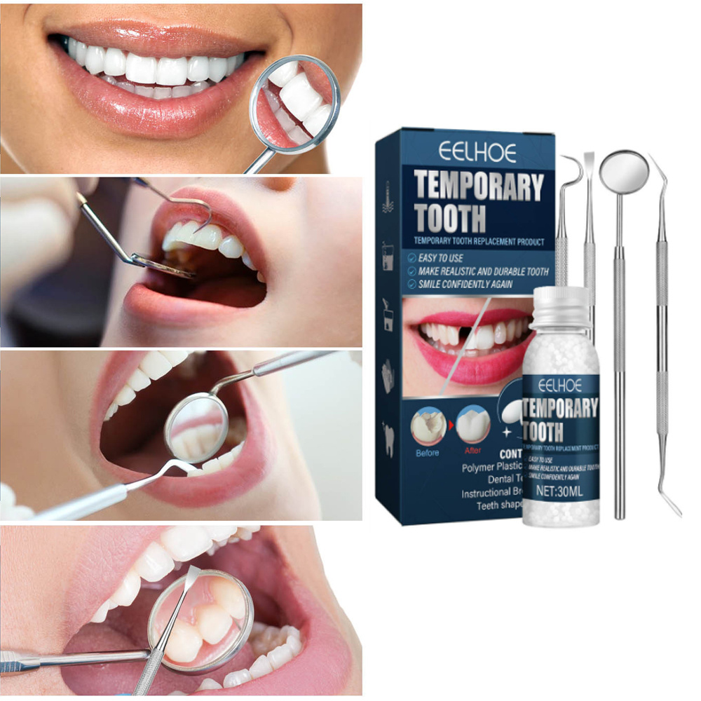 RuiKe Tooth Repair Kit, Temporary Teeth Replacement Kit Reusable