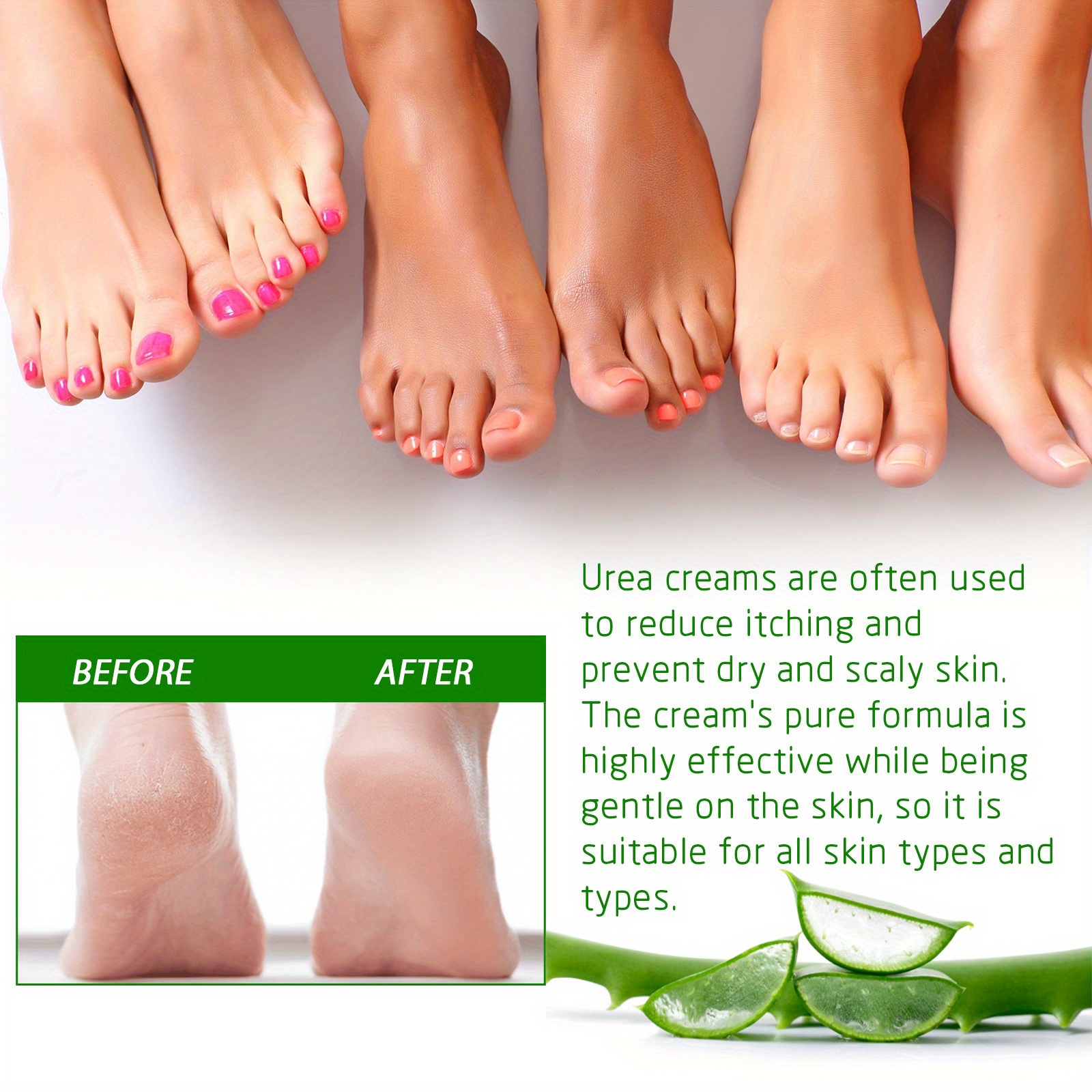 Allantoin Foot Cream With Aloe Vera Tea Tree Oil And - Temu