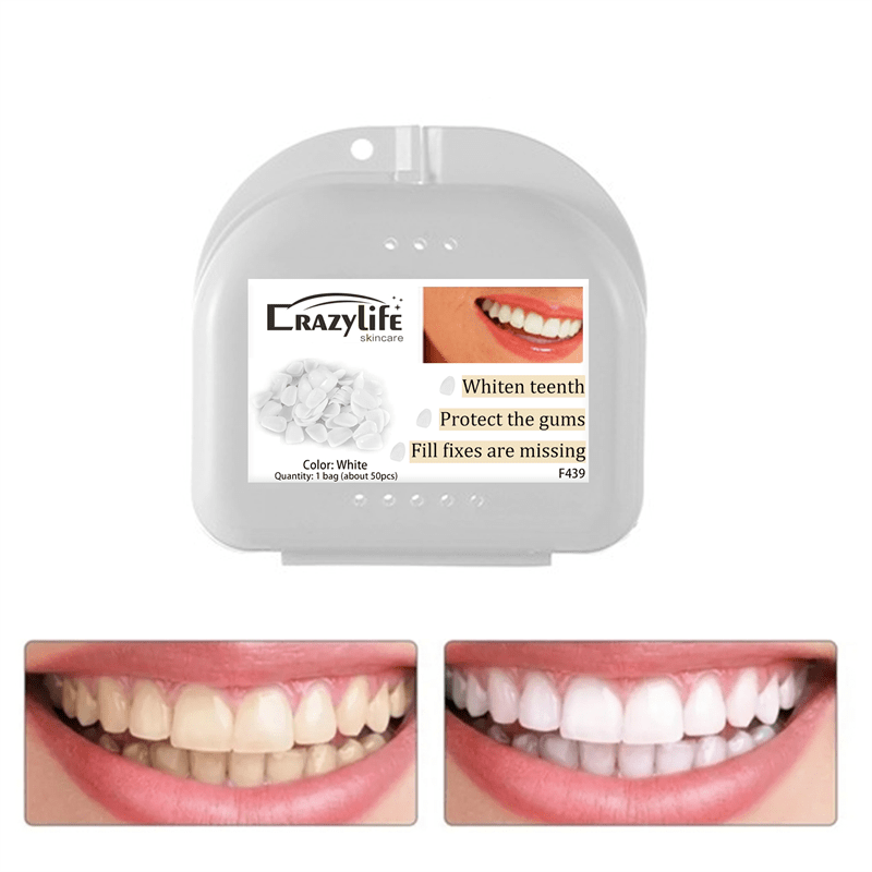 Dental Temporary Tooth Crown Veneers Front Teeth With - Temu