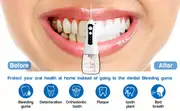oral irrigator wireless electric interdental cleaner water flosser for teeth gums dental care 3 modes 5 replacement nozzles usb rechargeable suitable for travel details 0