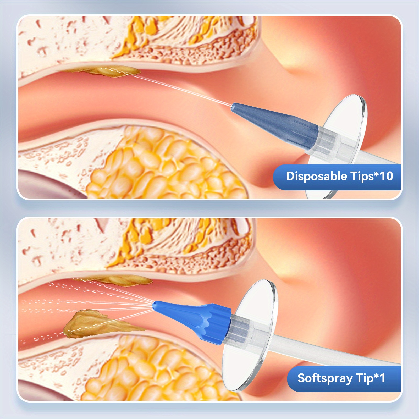Kit D'outils Enlever Cérumen Irrigation Oreilles Rinçage Temu France