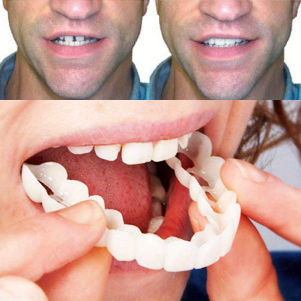 

1 X Dental Veneers Comfort White Denture Top Veneer Denture Accessory Men Women