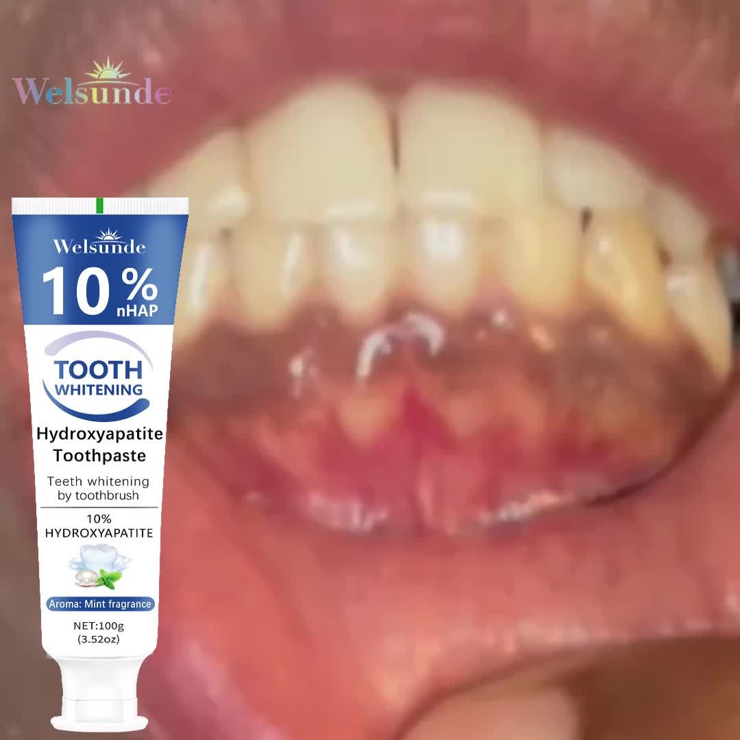 3pcs Hydroxyapatite toothpaste - Hydroxyapatite toothpaste, 10% hydroxyapatite tooth, peppermint essential oil deep cleaning paste, fresh breath strengthen dental care, basic cleaning, suitable for everyone - Image 11