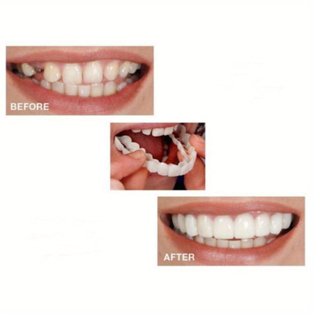 

1x Dental Veneer Comfortable White Denture Crown Veneer Denture Accessories For Men And Women