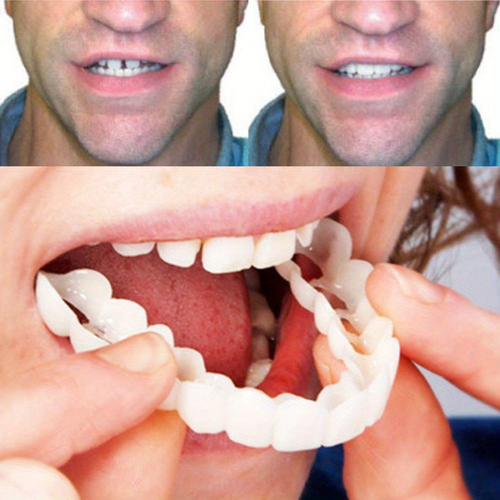 

2pc, Dental Veneer Comfortable White Dentures Top Veneer Dentures Accessories For Men And Women