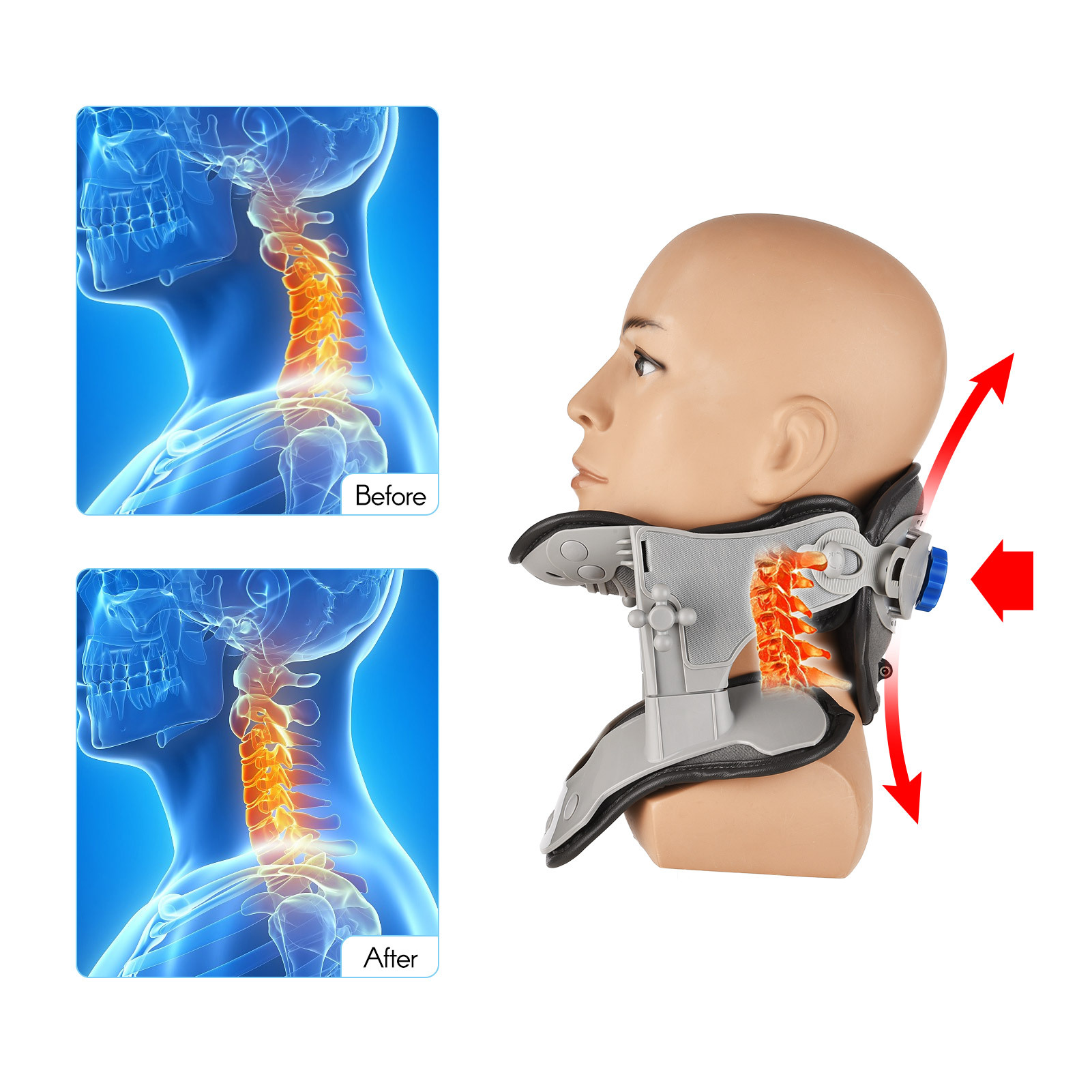 Lixada Adjustable Neck Brace Support Traction Device for Neck Support and Comfort, Non-Electric Manual Adjustable Height, Gray
