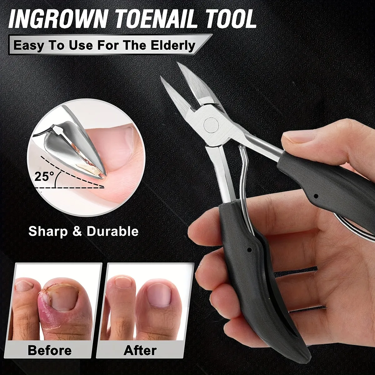 how to use ingrown toenail clippers