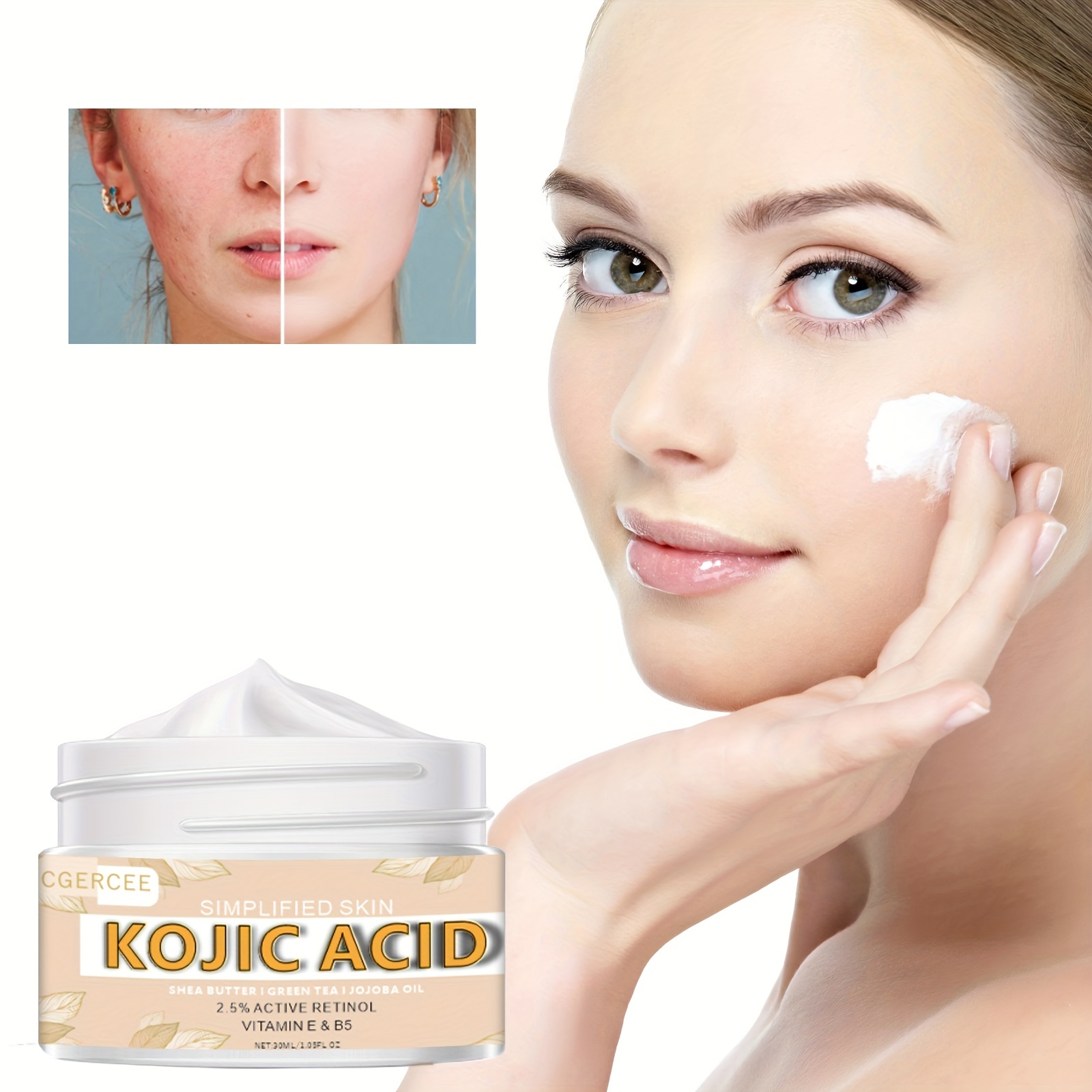 Kojic Acid Cream for Dark Spots and Wrinkles