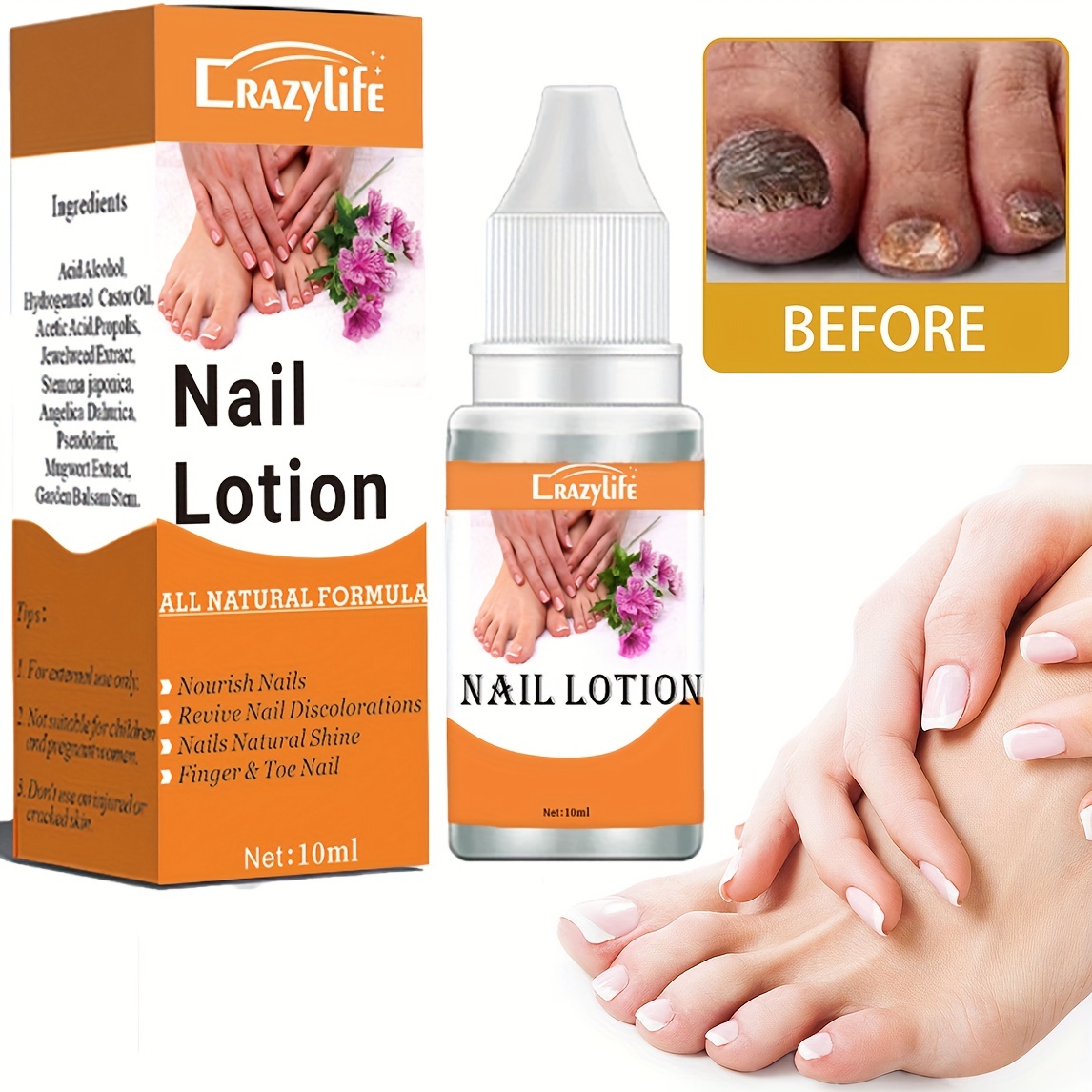 Is Laser Nail Fungus Treatment Effective? - Sun City Medical Clinic