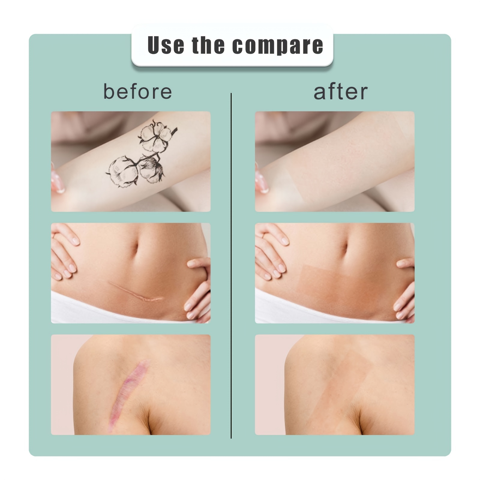 Skin Concealer Sticker Scar Tattoo Acne Cover Waterproof Sticker