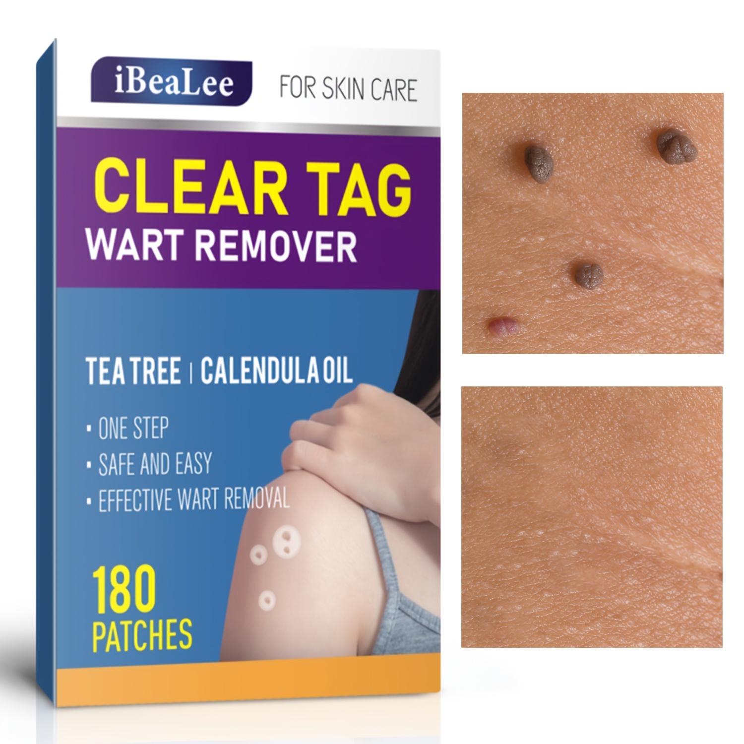 Ibealee Tag And Wart Remover, Skin Tag Removal Natural Skin