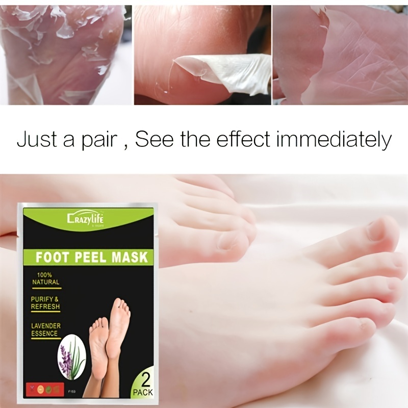 Foot Peel Exfoliator Gel For Smooth And Soft Feet Callus - Temu