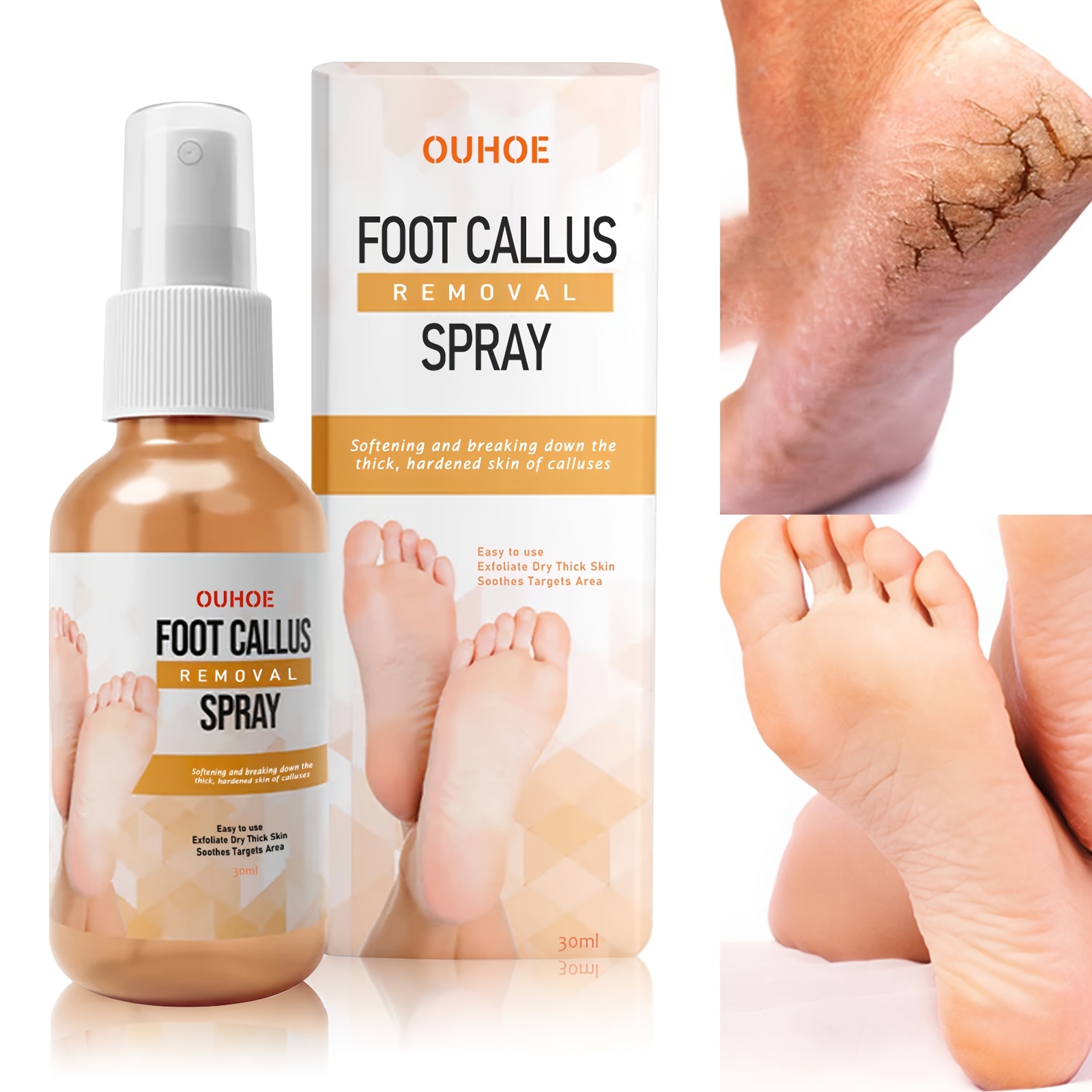 Foot Callus Remover Spray 1.01 Oz Quickly Soften Calluses
