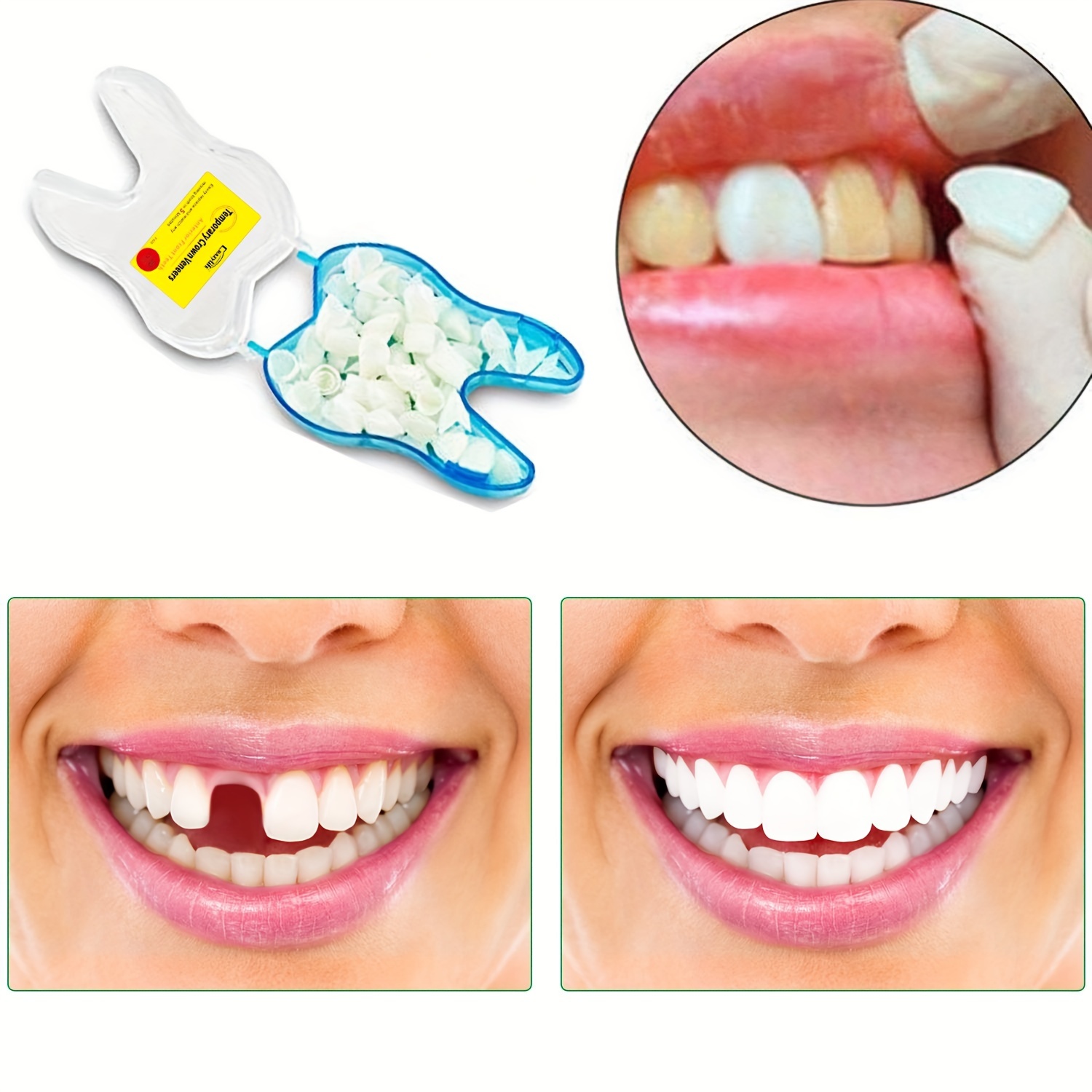 2 pares de dientes postizos carillas, carillas dientes cosméticos cubierta  dental dientes falsos dentaduras temporales dientes artificiales