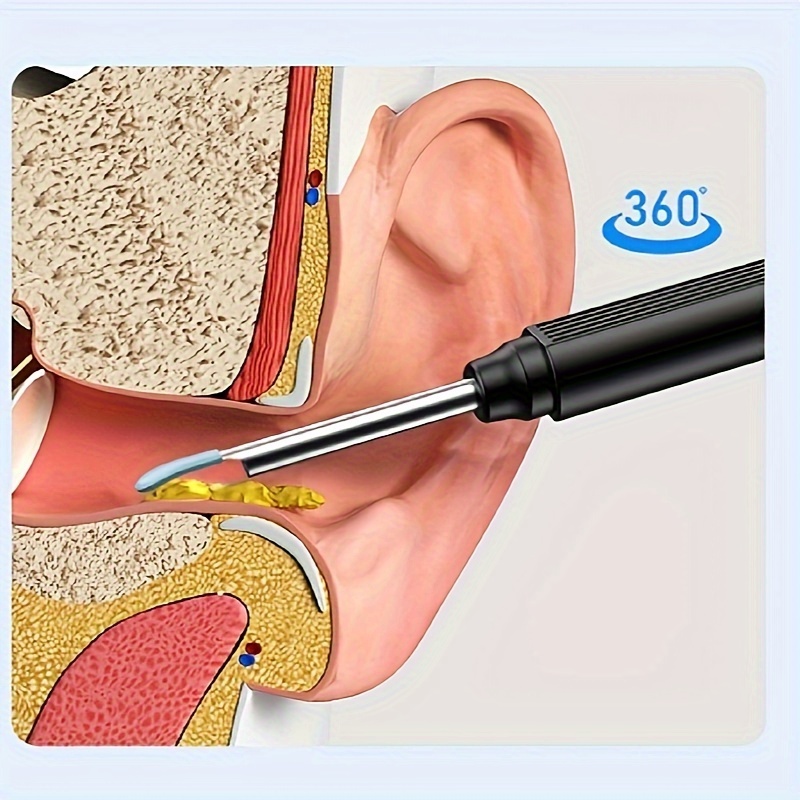 Intelligent Ear Scoop, Otoscope, Visual Ear Scoop, Outils de nettoyage d' oreille lumineux intelligent de 4,2 mm, Endoscope professionnel de 500 W -  Temu France