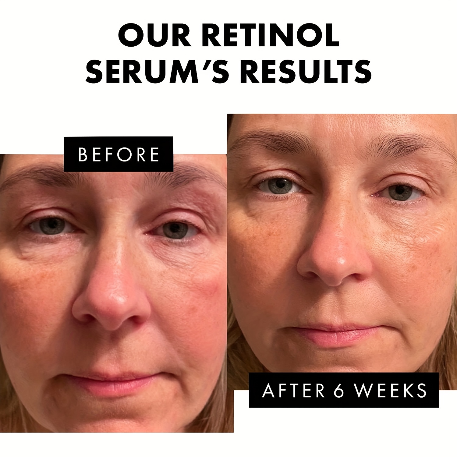 Retinol Collagen & Hyaluronic Acid Double Chin Reducer & Night Cream