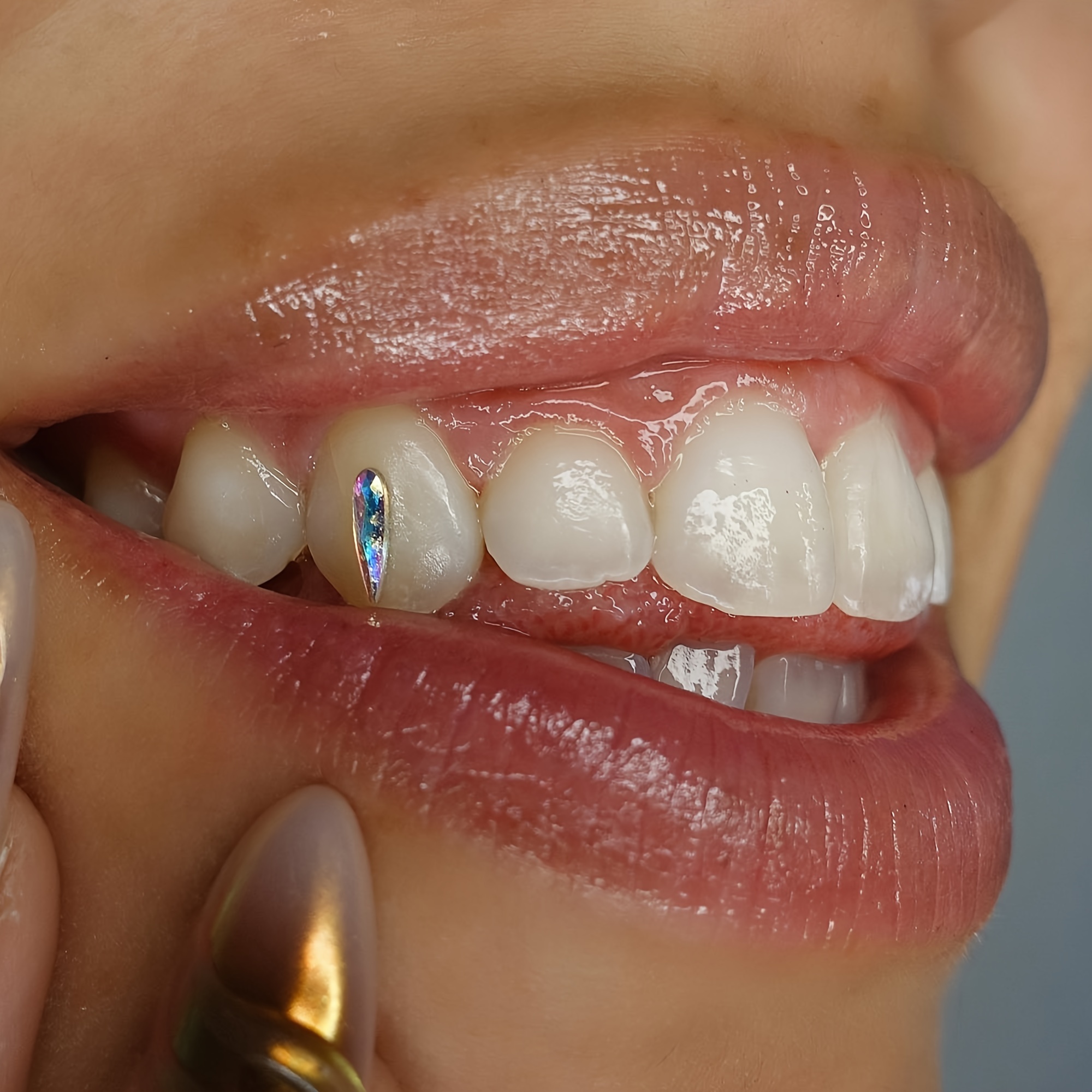 Artificial Tooth Gems Tooth Gem Kit - Temu