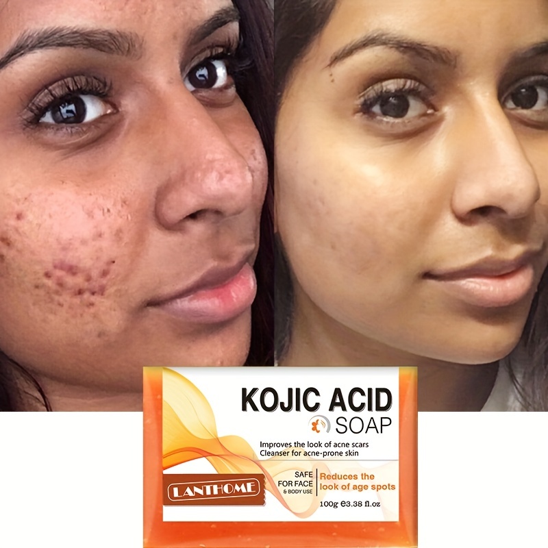 kojic acid soap before and after