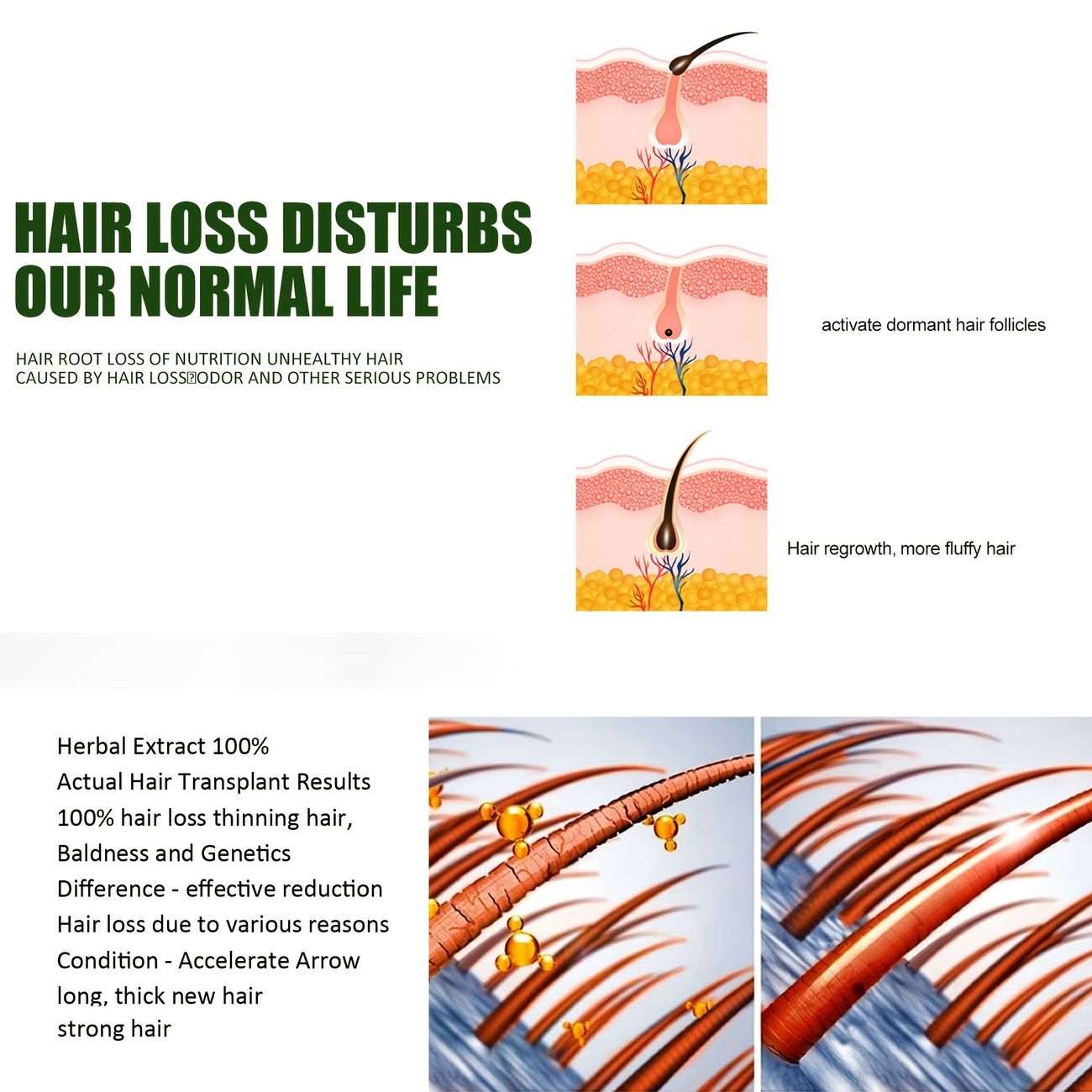 Hair Care Essence Spray Hair Strengthening Nutrition Nourishing Hair Roots  Hair Care Hair Stimulating Fluid - Beauty & Personal Care - Temu