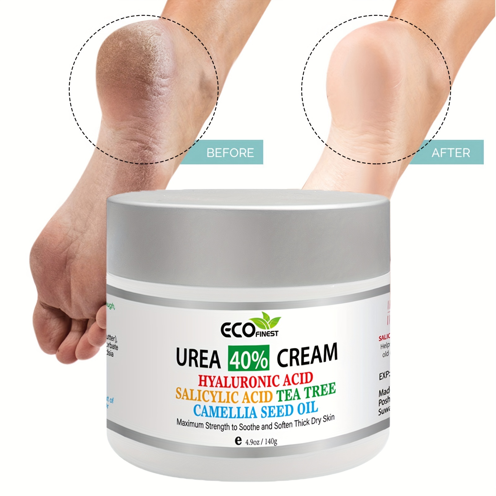 Urea Cream 40 + 2 Salicylic Acid 4 9 Oz Callus Corn Remover Foot Cream