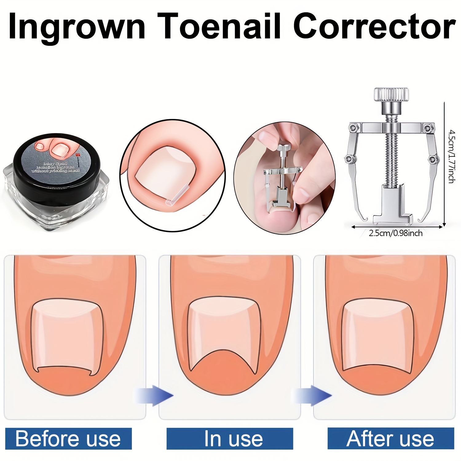 Ingrown Toenail Clippers Kit For Seniors Thick Toenails - Heavy Duty  Podiatrist Toe Nail Cutter For Men, Professional Easy Grip Handle Stainless  Steel Sharp Curved Grooming Kit With Pu Bag - Temu