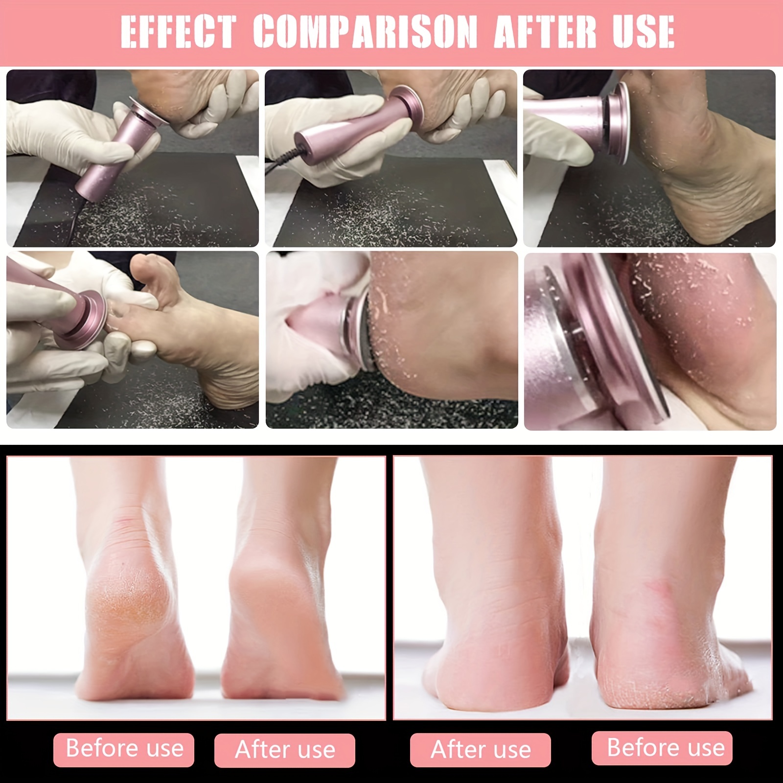 Professional Pedicure Tools Foot Dead Skin Remover Electric Foot