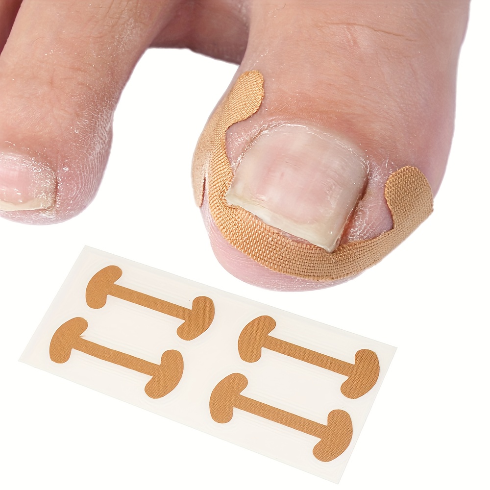 8pcs Ingrown Toenail Foot Corrector Stickers Toe Nail Care Pedicure Tools