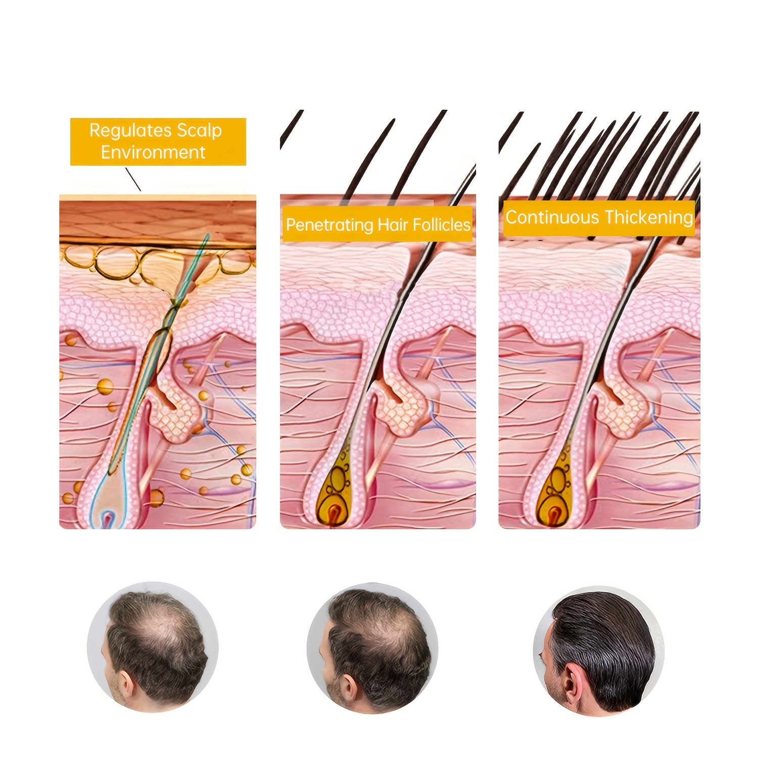 30ml Hair Regression Serum for Healthy Hair