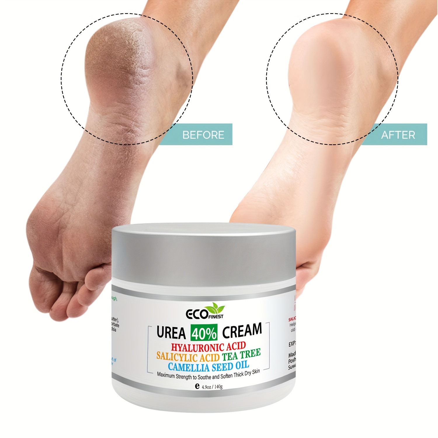 Foot Cream, Best Callus Remover for Dry Feet, Hands, Elbows, Knees, Cracked  Heel Repair Cream with Heel Socks, Urea Foot Cream Intensively Moisturizes