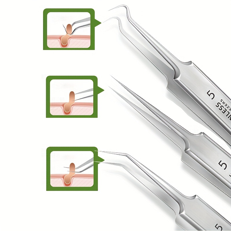 Stainless Steel Blackhead Remover Comedone Pimple Extractor - Temu