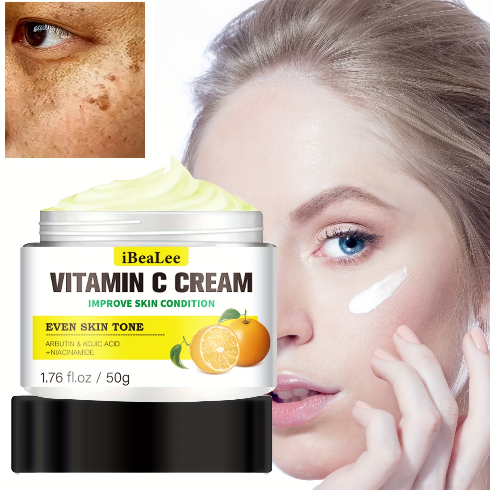 Dark Spot Remover for Face and Body, Dark Spot Corrector for Face, Sun  Spots Melasma Cream and Freckle Remover- Formulated with Arbutin,  Niacinamide & Vitamin E