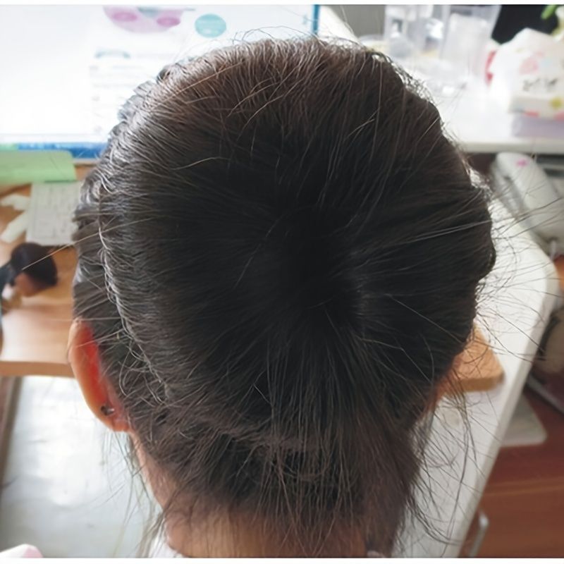 1pc Hair Bun Crown Shapers Magic Roll Tool Hair Ring Diy Hair Bun Maker  Women Hair Bands | Shop The Latest Trends | Temu